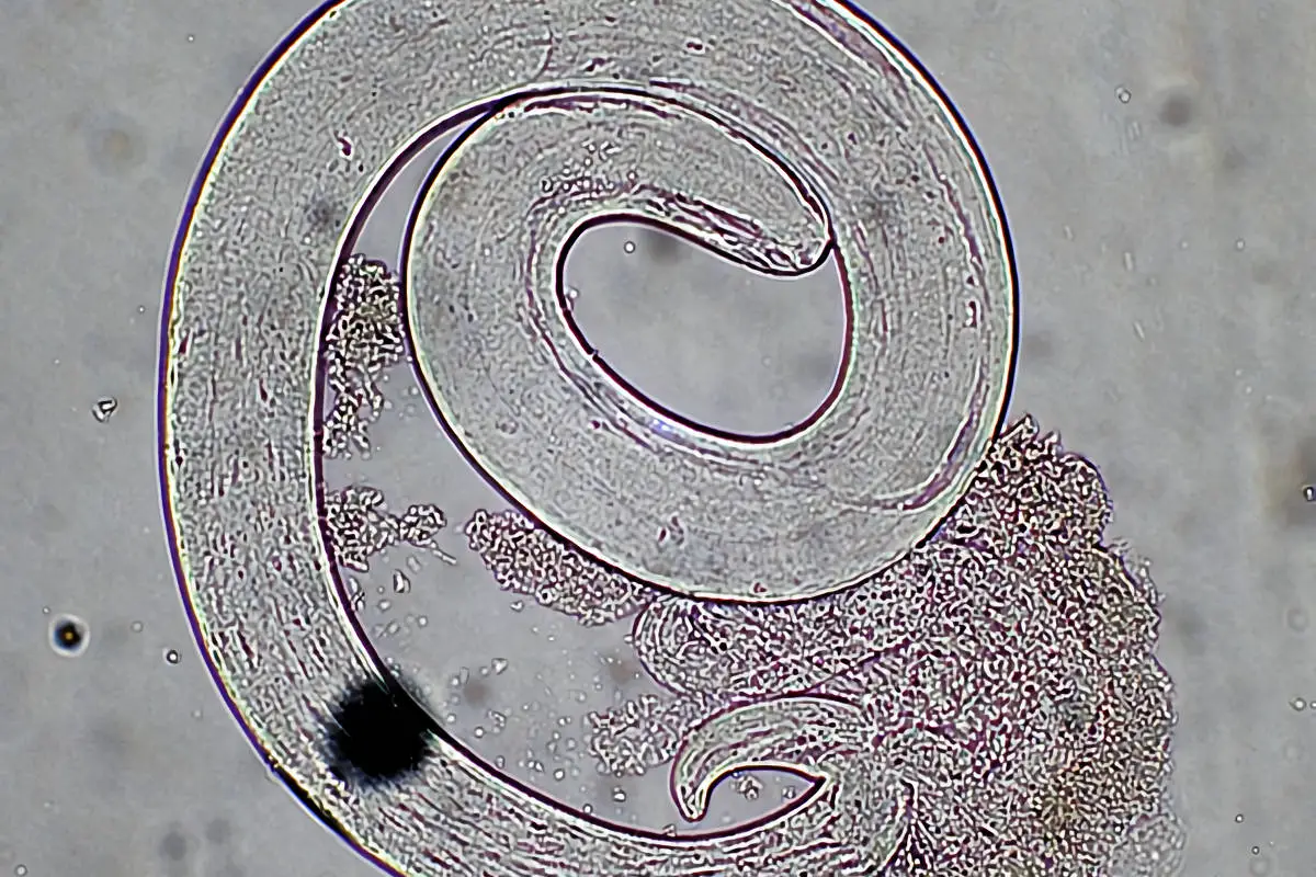 Личинки трихинеллы. Вид трихинелла Спиралис. Трихинелла спиральная - Trichinella spiralis. Трихинелла Спиралис в микроскопе.